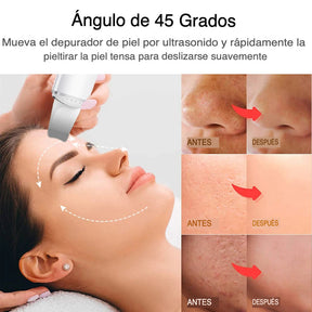 DermaVibra - Exfoliador Ultrasónico para una Piel Radiante